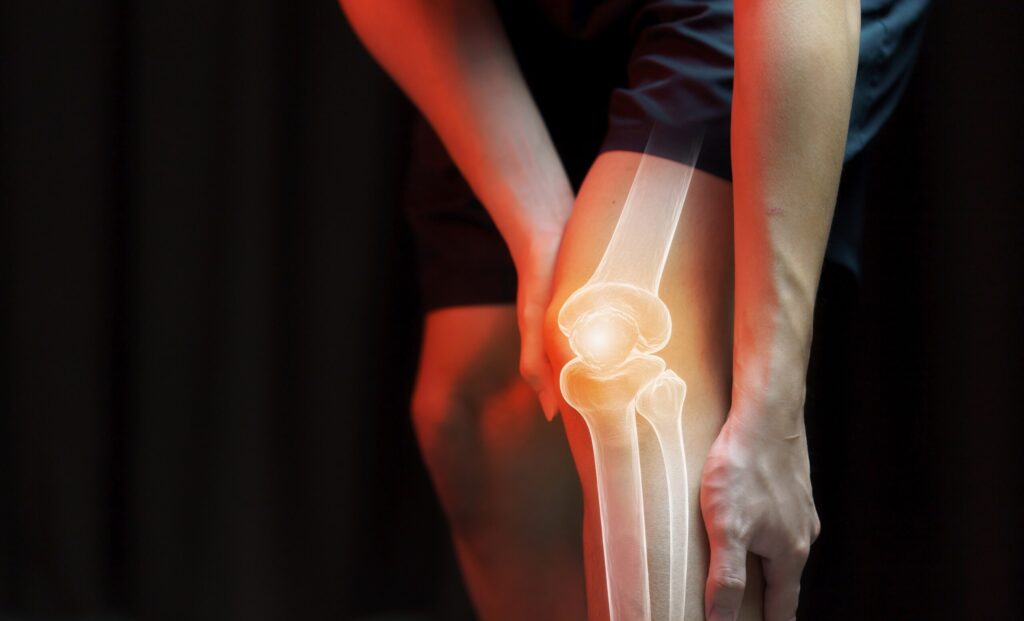 Knee Pain